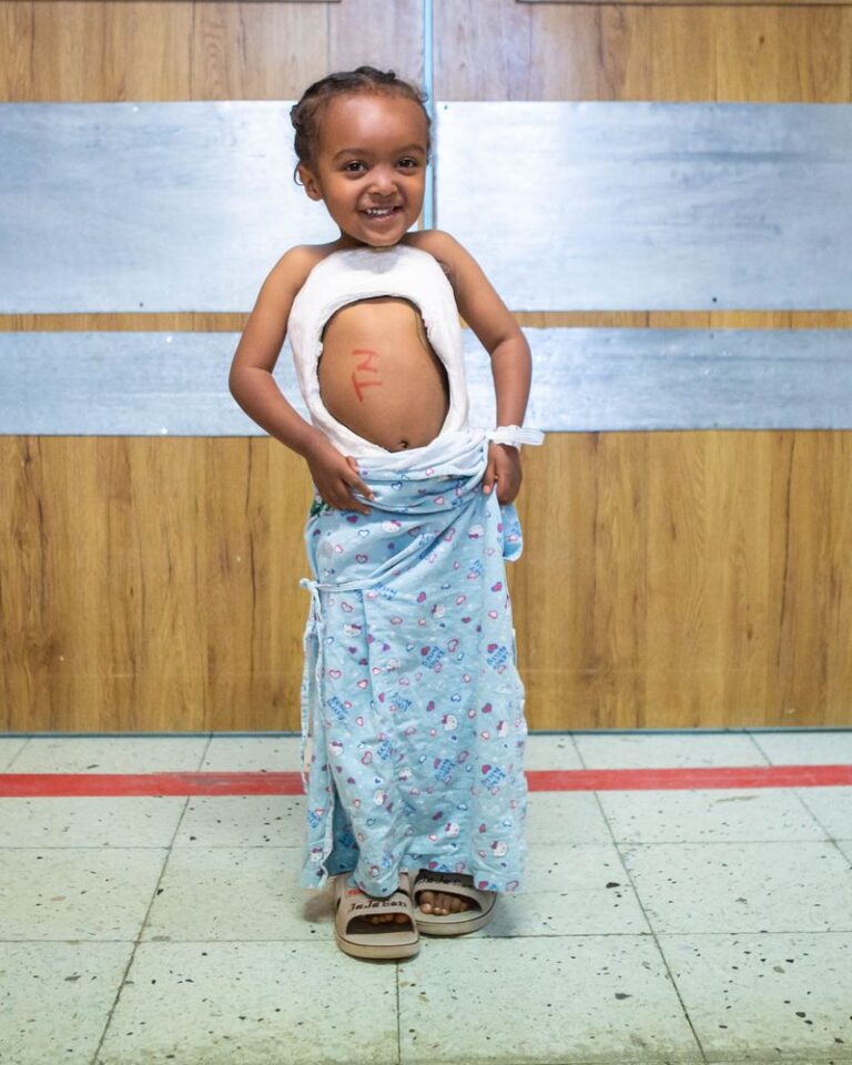 A child wearing a body cast to hold her spine in place. 